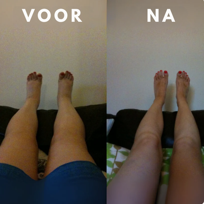Vibrelief™ - 3-in-1 massageapparaat tegen pijn en gezwollen benen