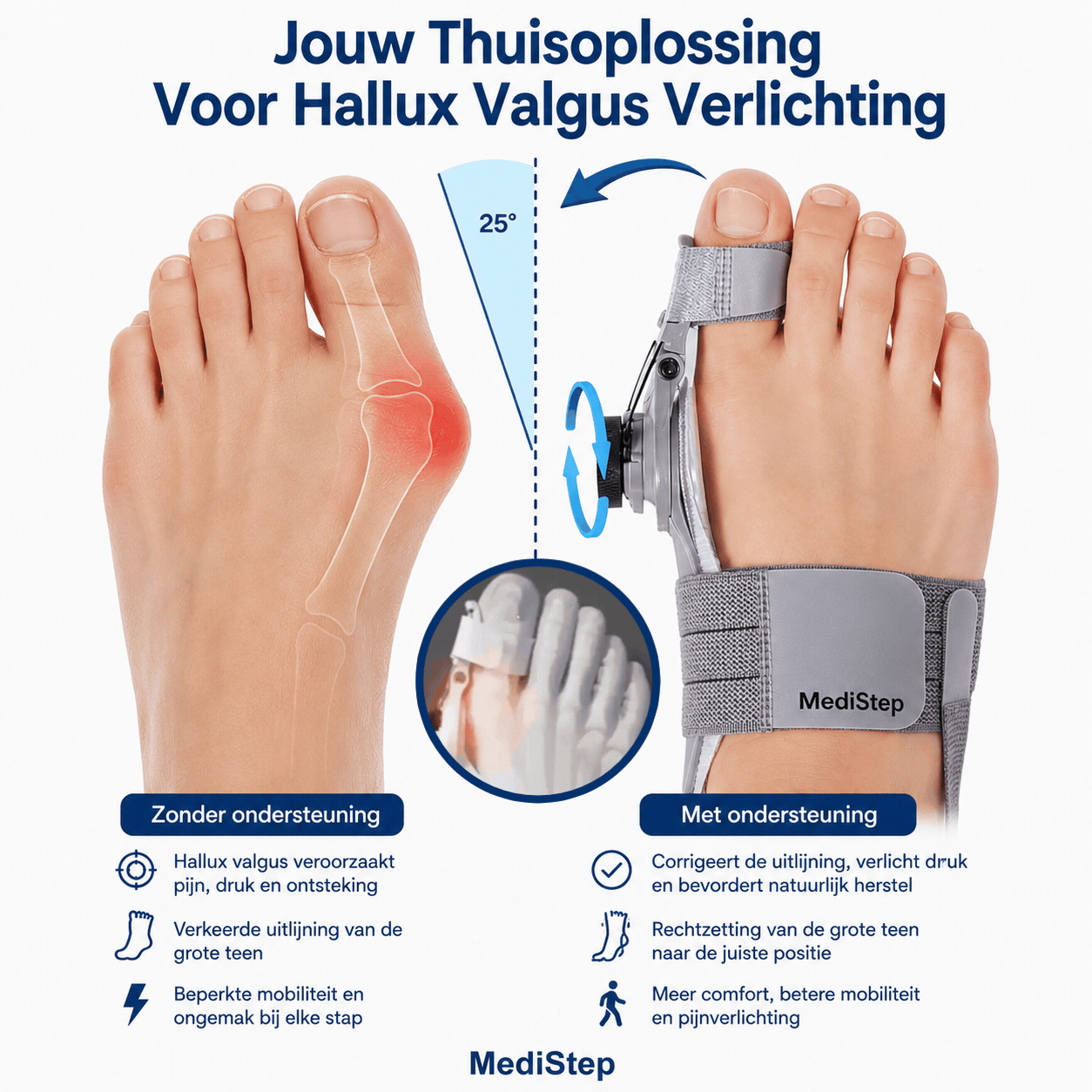 MediStep™ | hallux valgus correctie