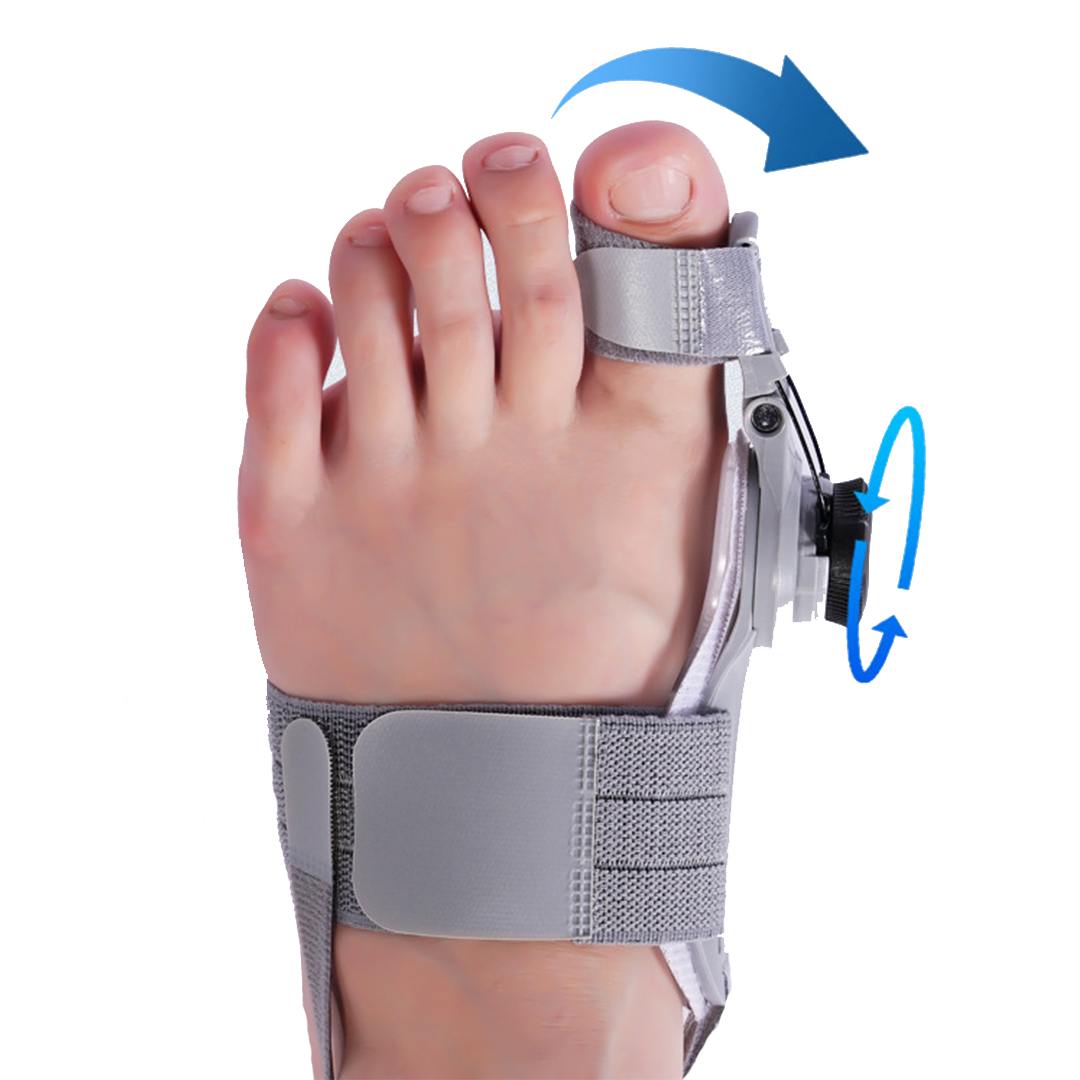 MediStep™ | hallux valgus correctie